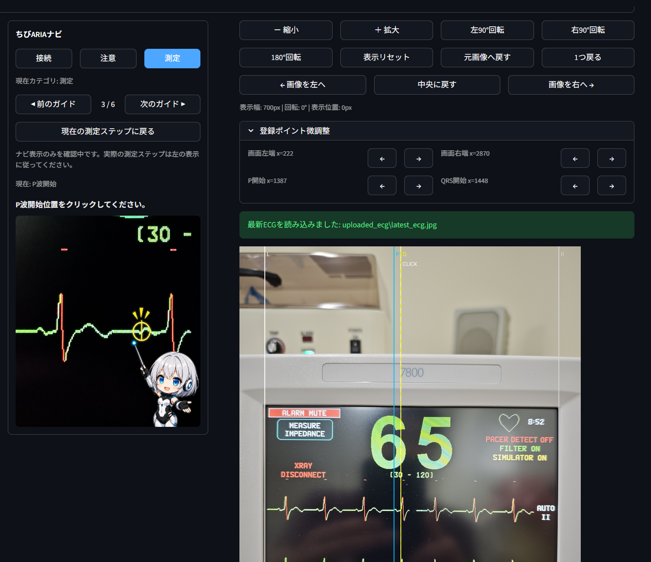 ARIA PQ Measure screen showing ECG image measurement workflow